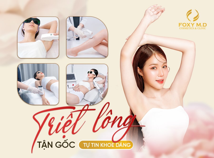 Bảng Giá Triệt Lông Tại Phòng Khám Da liễu Thẩm Mỹ Foxy M.D